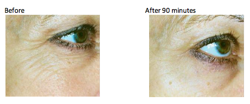 Murad Rapid Collagen Infusion Before & After // Belle Belle Beauty